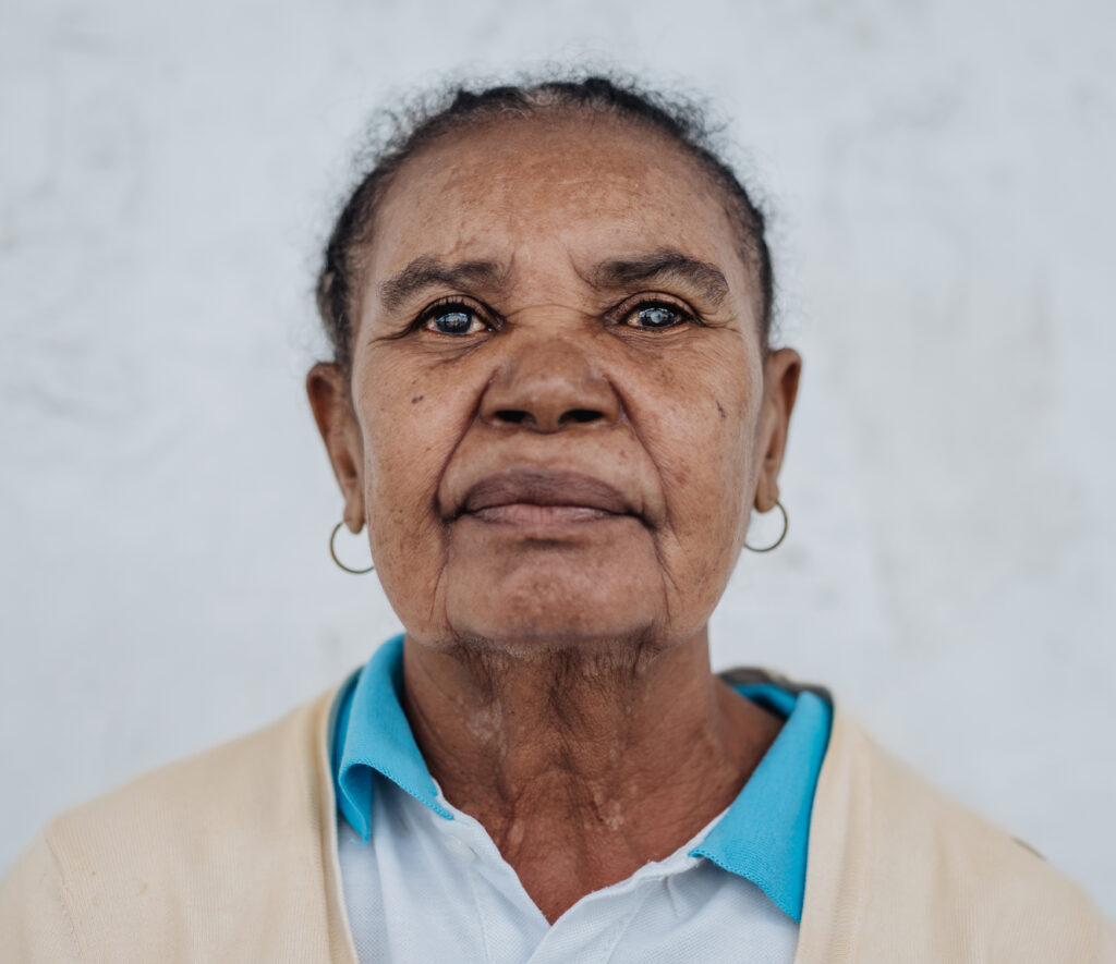 Porträtaufnahme der Patientin Delphine nachdem sie erfolgreich auf der Africa Mercy an den Augen operiert wurde.